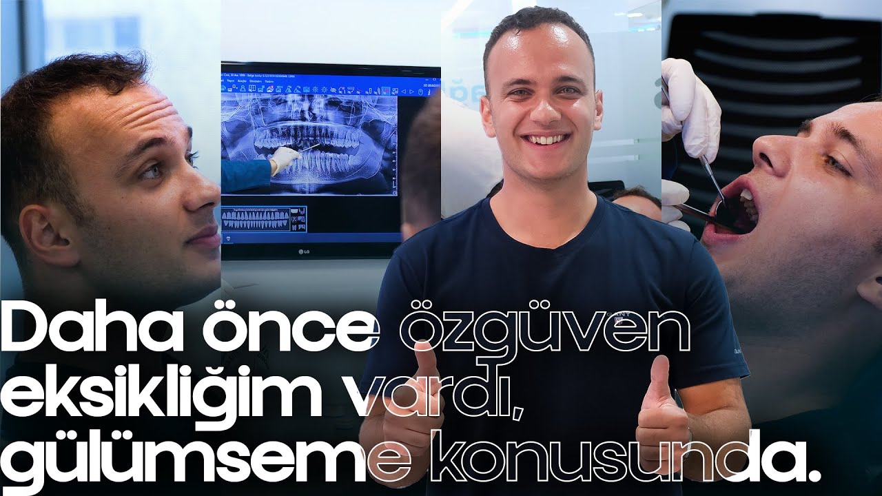 Kanal Tedavisi ve Kaplama Tedavi Süreci | Adem Çalık | İNCİ DİŞ KLİNİĞİ
