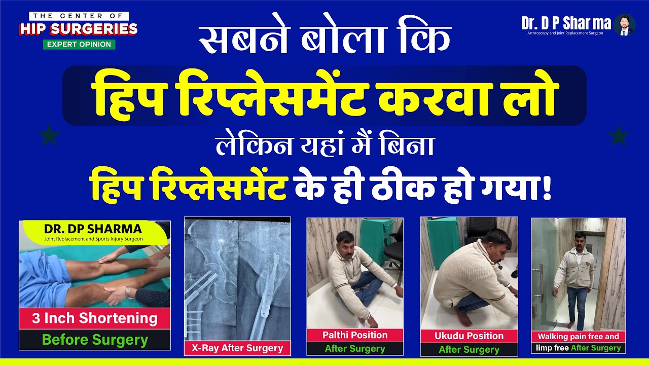 Success Without Hip Replacement | Shortening Correction | Center for Hip Surgeries India