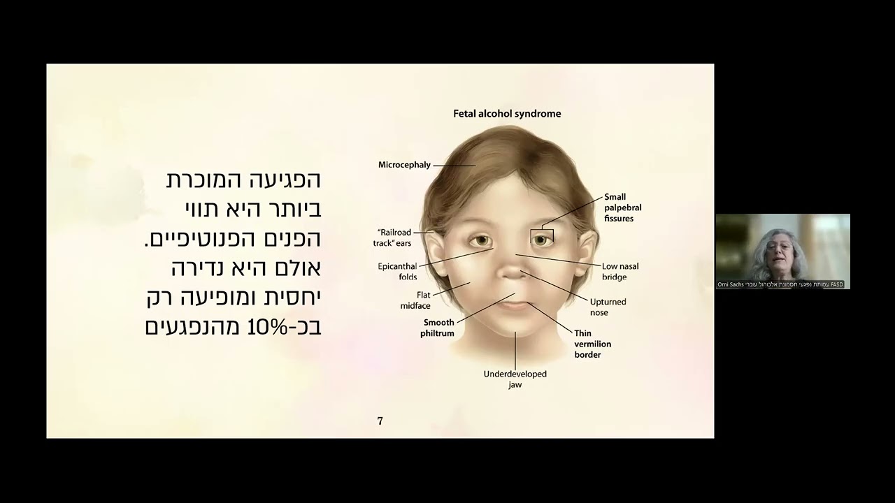 זום לציון היום הבינלאומי להעלאת המודעות להשפעת האלכוהול העוברי (אורני - עמותת FASD)