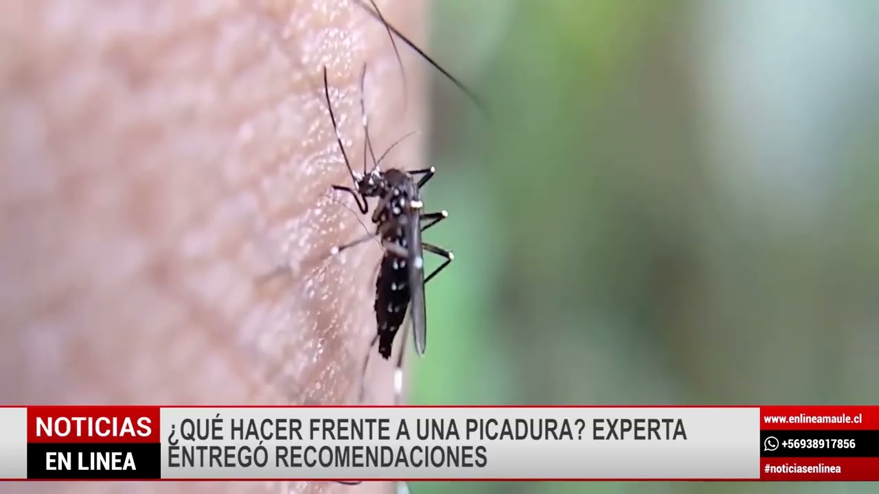 ¿Qué hacer frente a una picadura? Experta entregó recomendaciones