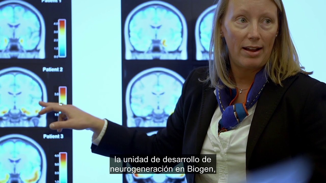 Biogen: Focused on furthering Alzheimer&rsquo;s disease research & treatment: Hope in the Age of Dementia