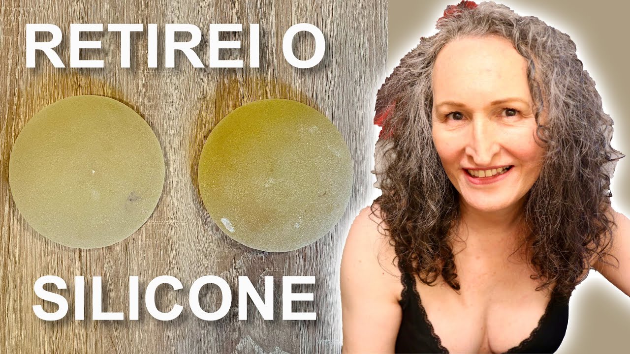 Retirei As Pr&oacute;teses: Explante de Silicone com Mastopexia