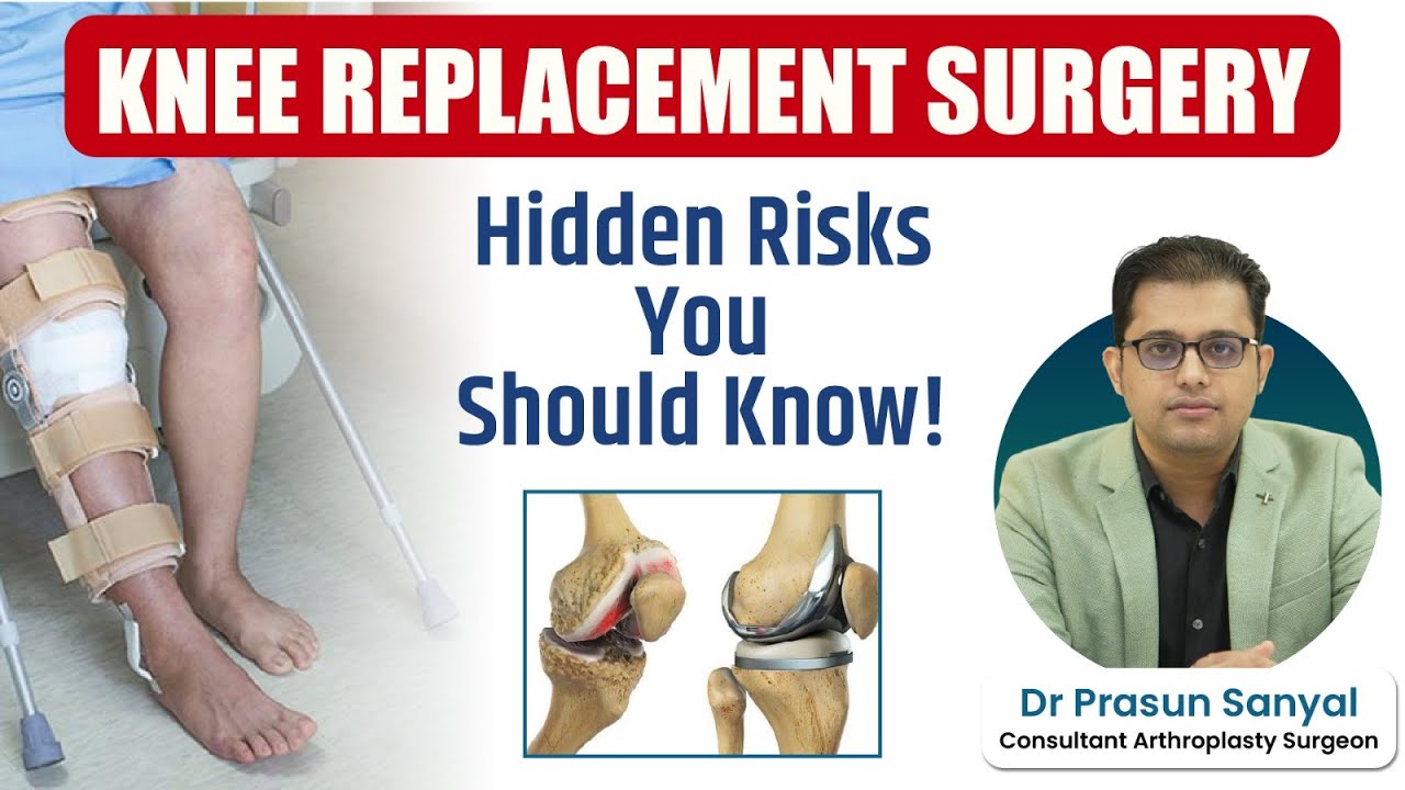 Knee Replacement Surgery | Rare But Real Complications You Should Know | Dr Prasun Sanyal