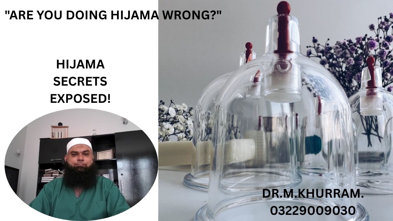 Are You Doing Hijama Correctly? | Complete Truth About Hijama, Cupping Therapy & Acupuncture