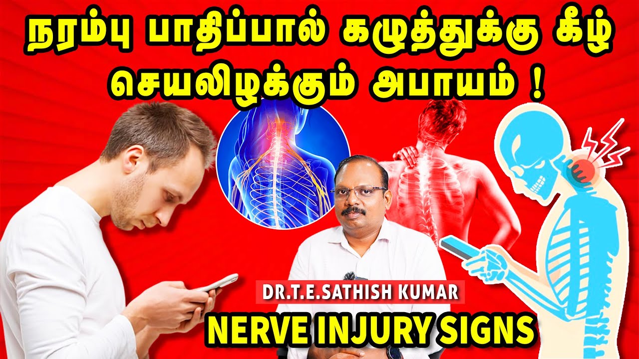 நரம்பு பாதிப்பால் கழுத்துக்கு கீழ் செயலிழக்கும் அபாயம் | Nerve Injury Signs | Dr. T.E. Sathish Kumar