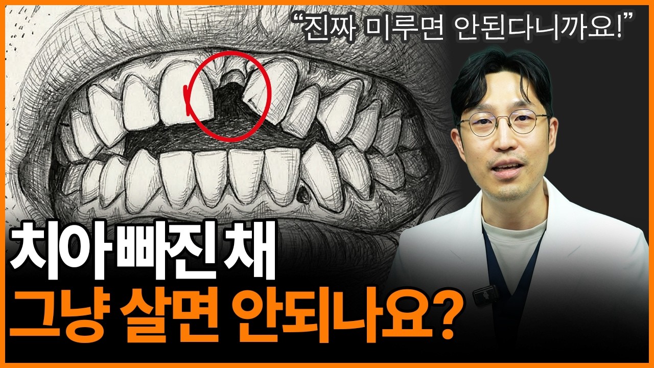 치아 빼고 그냥 살면 생기는 모든 문제 총정리!