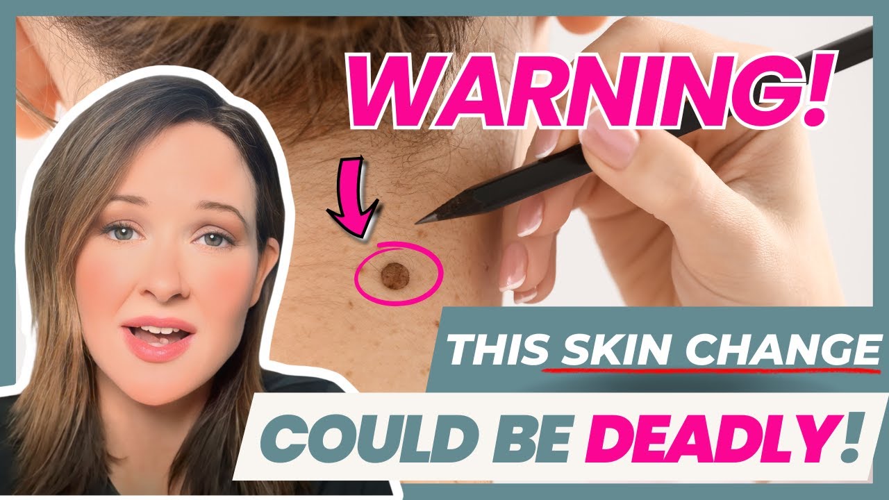 Doctor Answers Top Google Questions About Skin Cancer