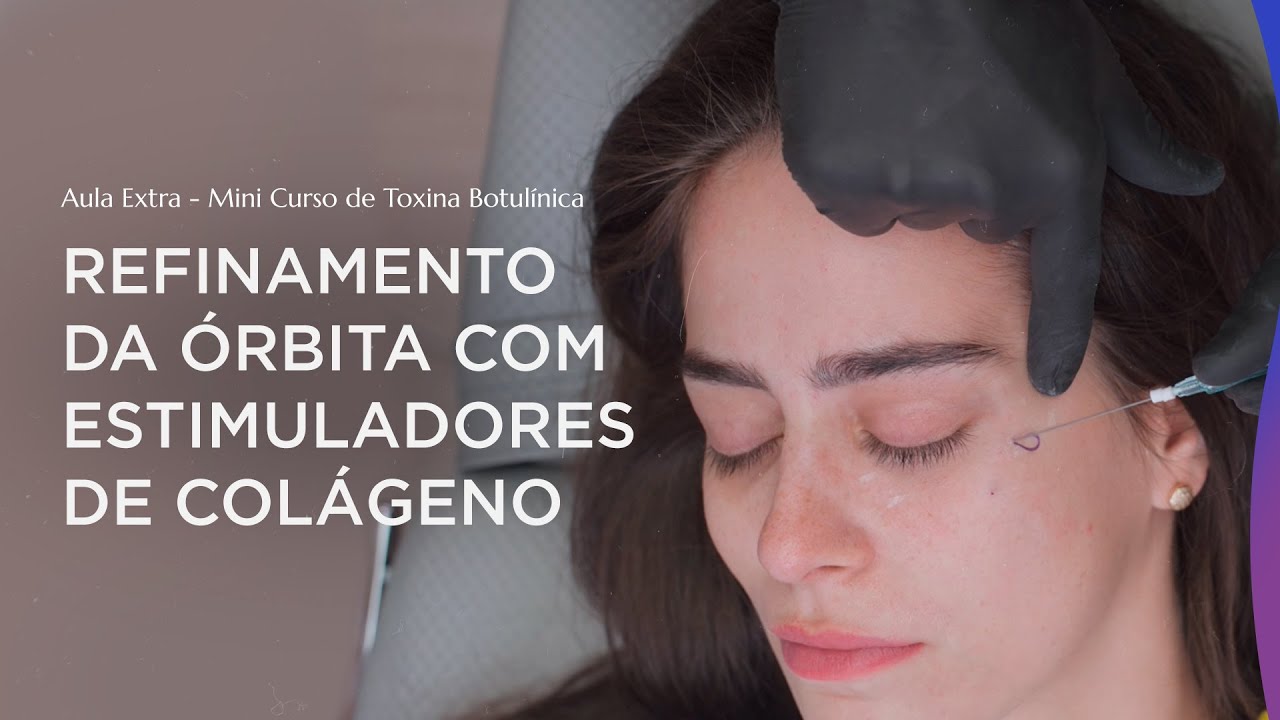 Aula 9 - Como fazer o refinamento da Região Orbital com Estimuladores de Colágeno