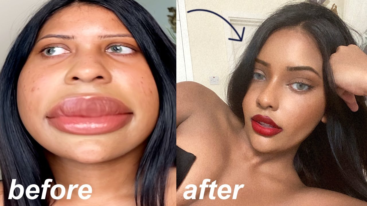 DIY plastic surgery... using tiktok hacks that actually work lol