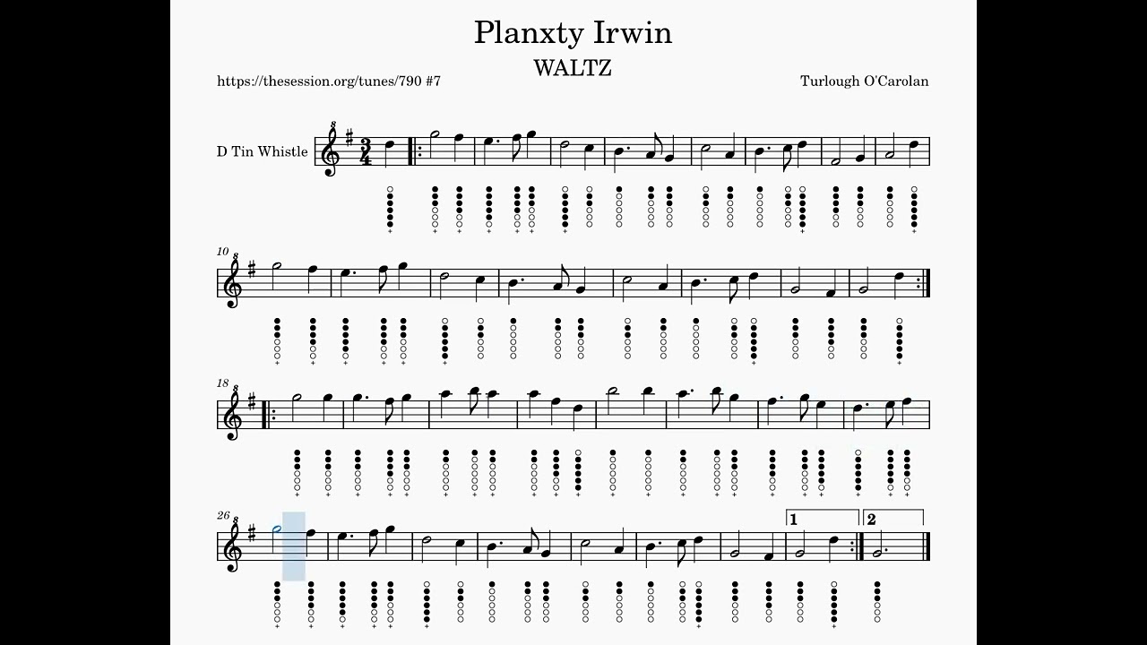 Planxty Irwin