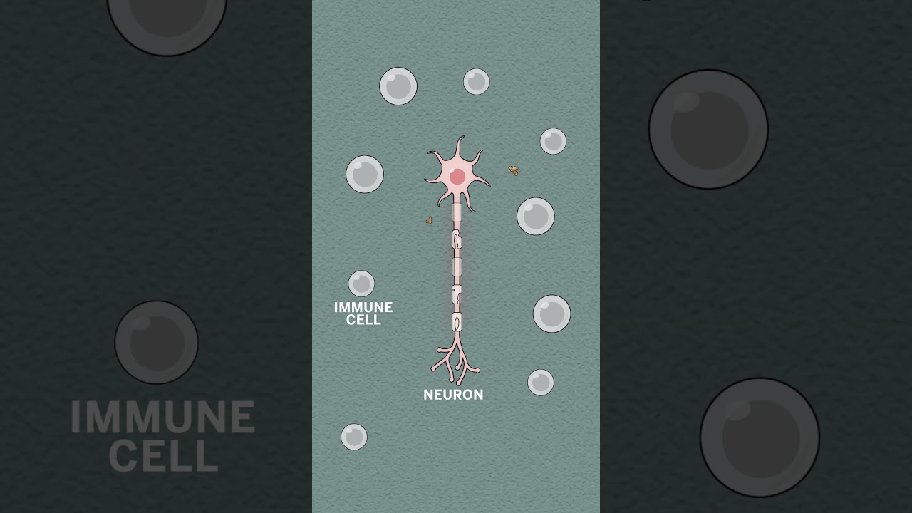 Treating autoimmune disease using your own cells