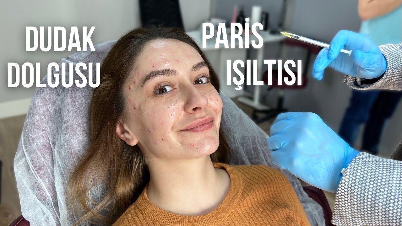 GENÇLEŞTİM RESMEN? - dudak dolgusu ve paris ışıltısı sürecim, yeni cilt bakımı rutinim