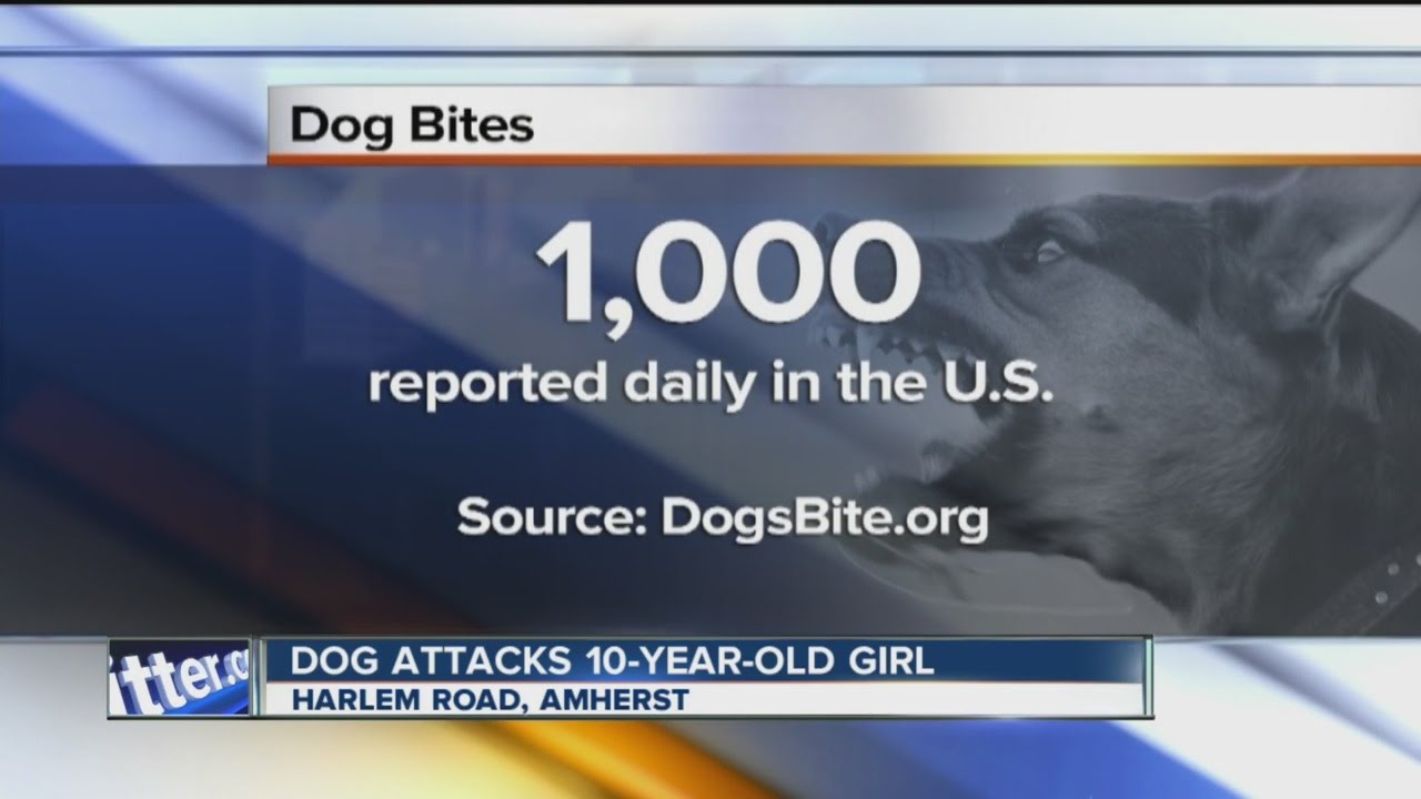 Girl, 10, spends 5 days in hospital after being bitten by dog on head, face