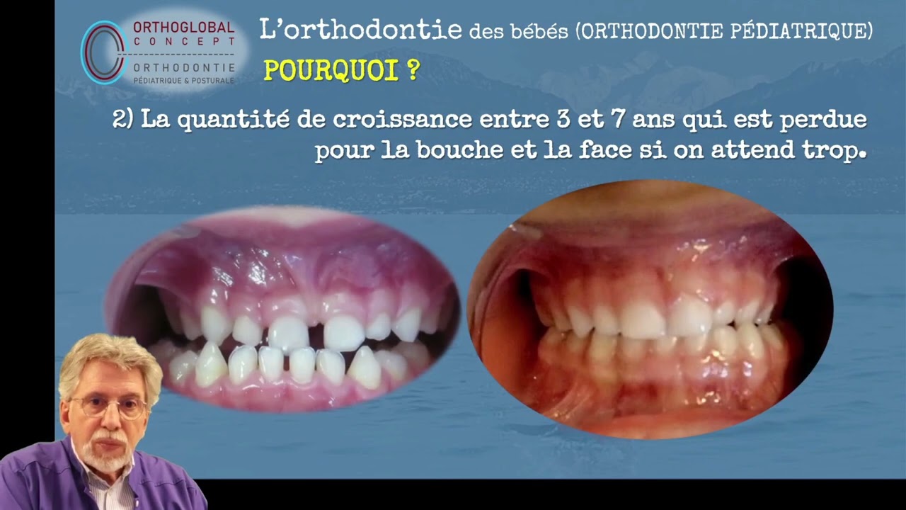 réponse aux 1ères questions