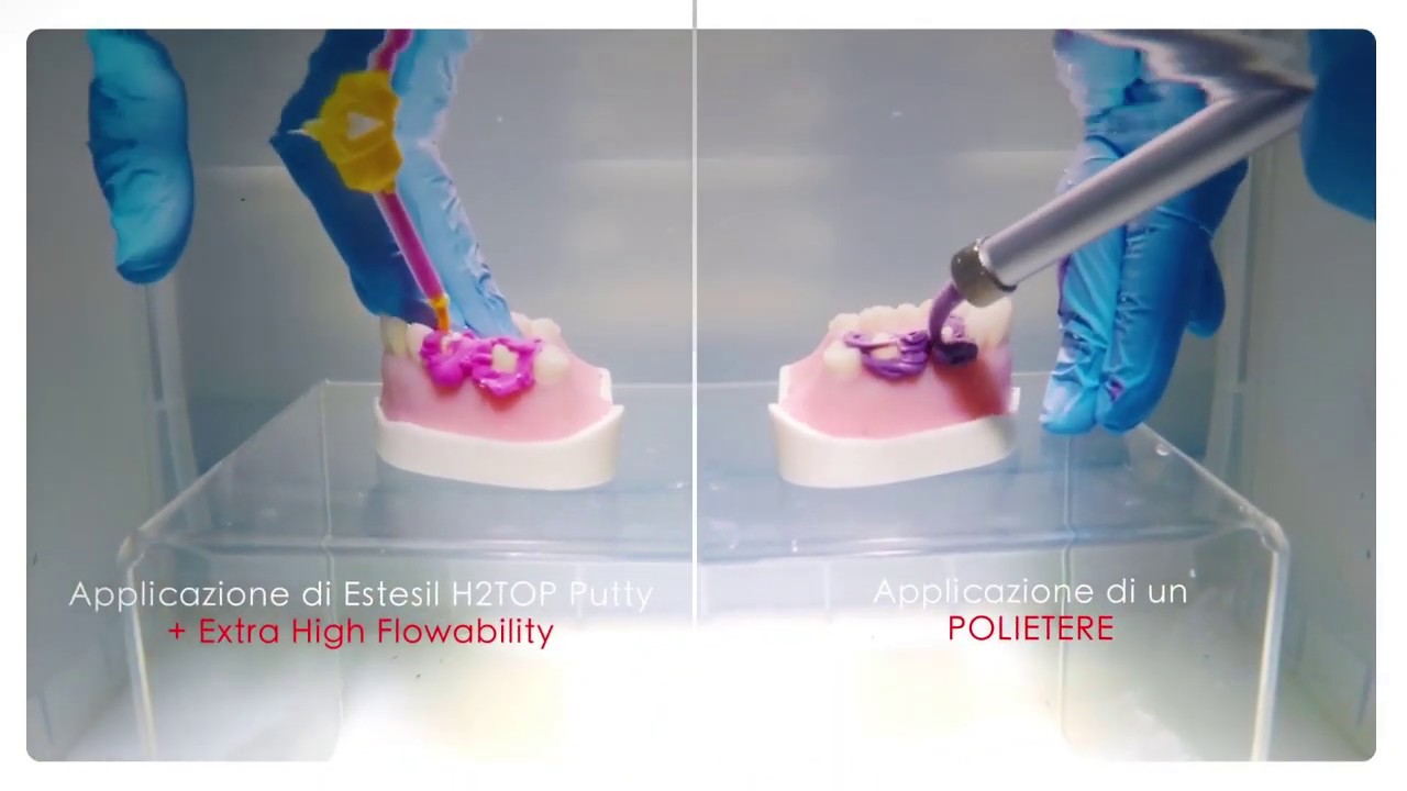 Estesil By Tokuyama Compared To Impregum Impression Materials