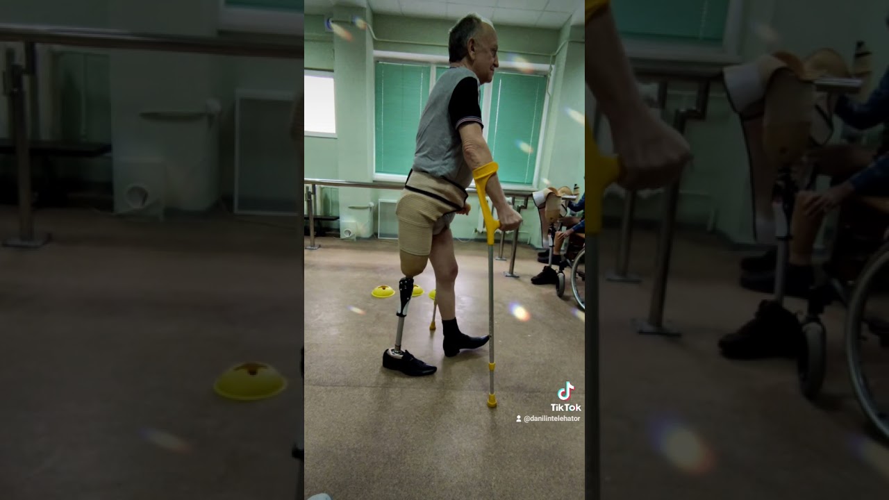 Walking on Crutches with Prosthesis (Above Knee Amputation)