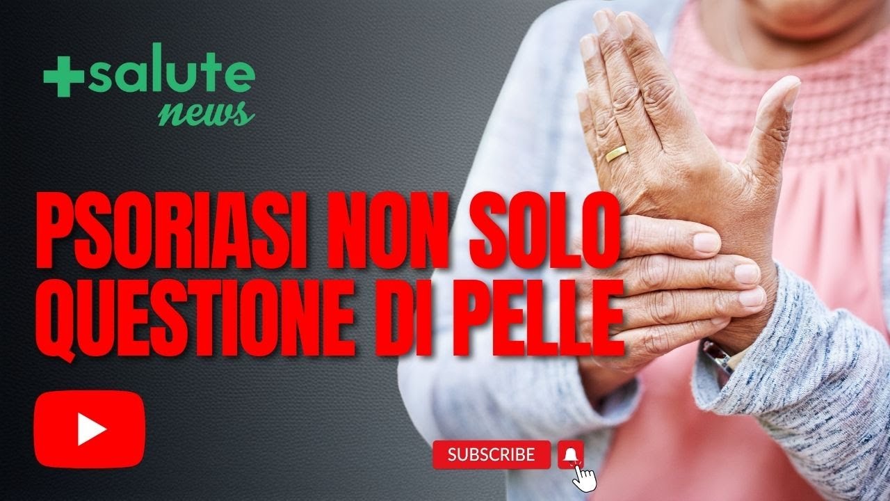 Psoriasi: non solo una questione di pelle ma vera e propria malattia psoriasica. +SALUTE NEWS