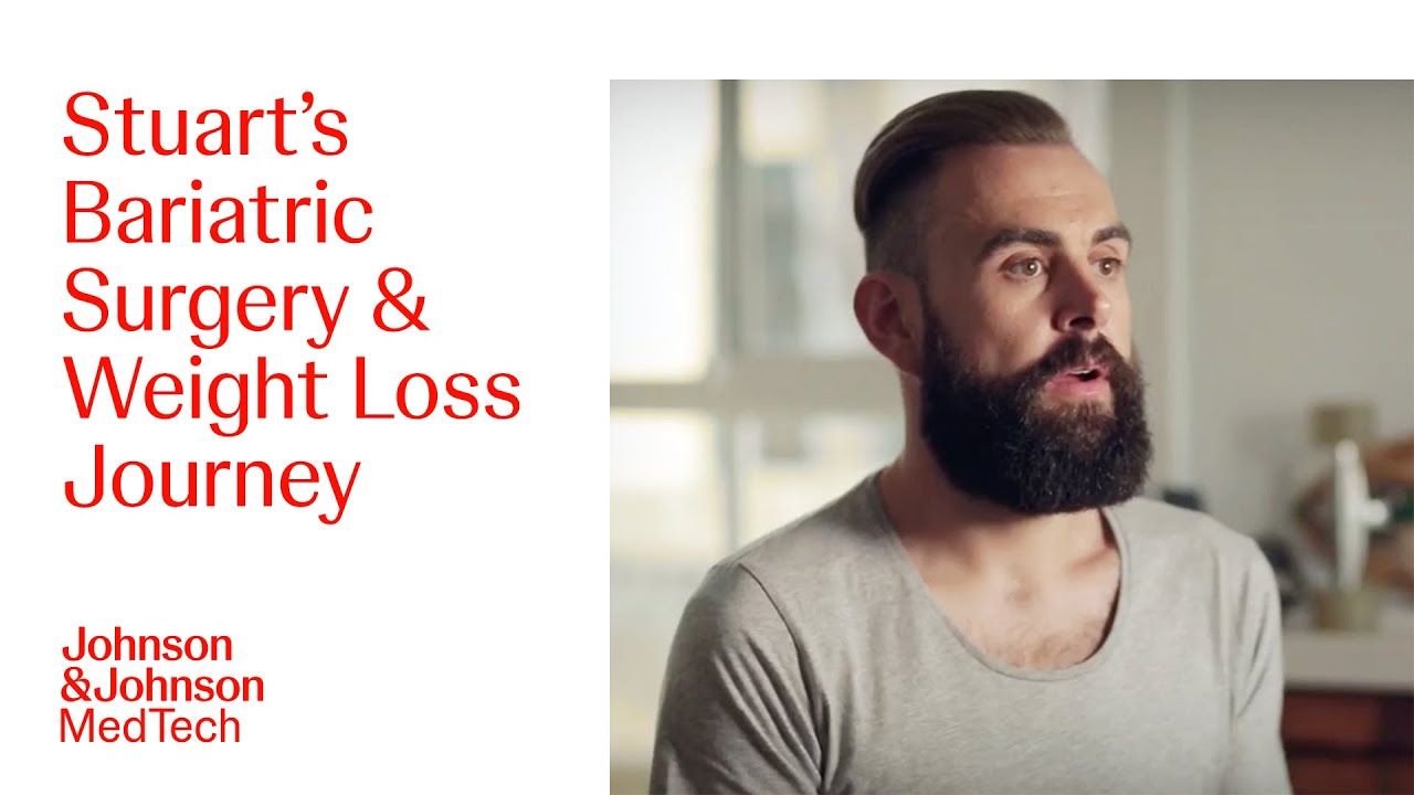 Stuart's Bariatric Surgery and Weight Loss Journey | J&J MedTech