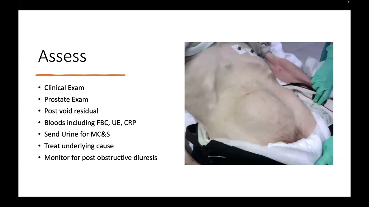Urology - Common Conditions (Part 1)