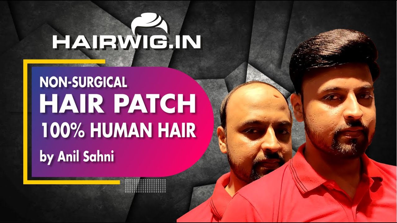 Hairwig and Hair patch in Varanasi | 100%Human Hair | Call : 8979775051, 9935383893