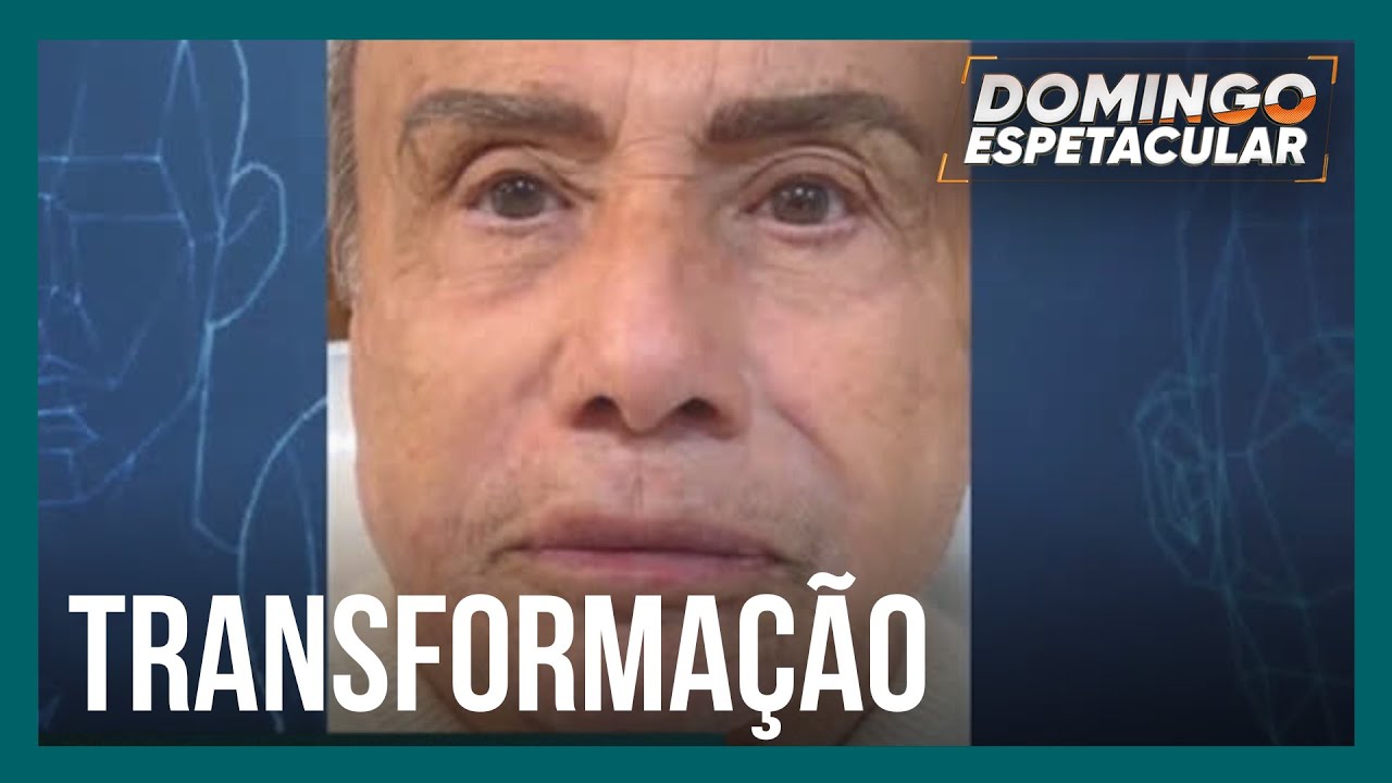 St&ecirc;nio Garcia faz harmoniza&ccedil;&atilde;o facial aos 91 anos de idade