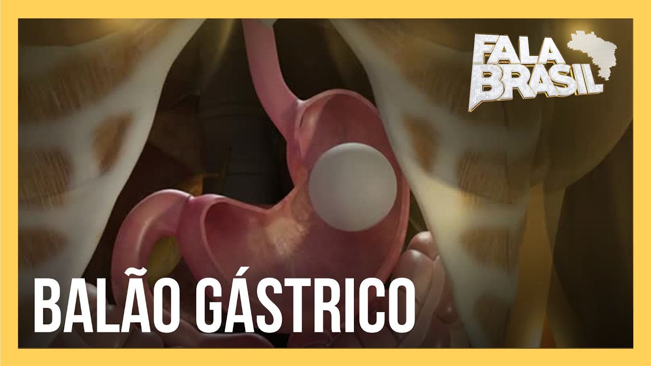 Balão gástrico: saiba como funciona e quais os riscos do procedimento para emagrecer