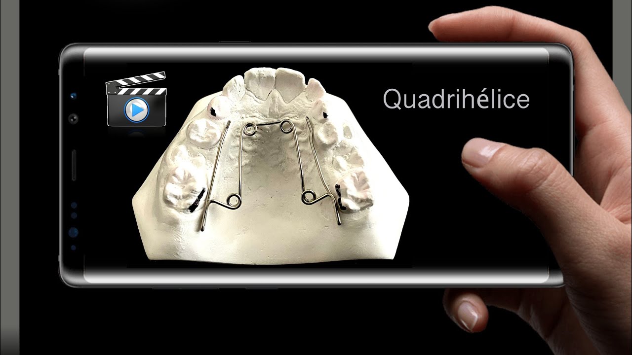 QUADRIHÉLICE- etapas de confecção.