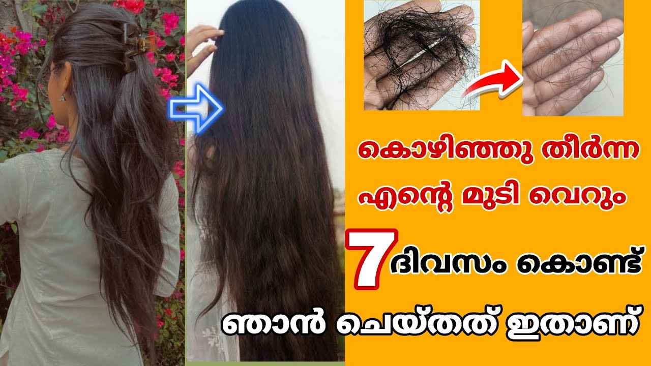 🔥💯 കൊഴിഞ്ഞു പോയ മുടി വരെ തിരിച്ചു വരും അതും 7 ദിവസം കൊണ്ട് 😱 മുടി തഴച്ചു വളരാൻ Magical Hair Water ✅💯