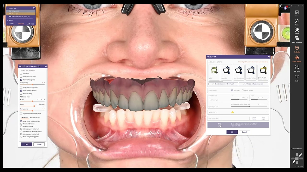 Kois Facial Reference Glasses (KFRG) to Kois Digital Transfer Adapter exocad 3.2 Instruction