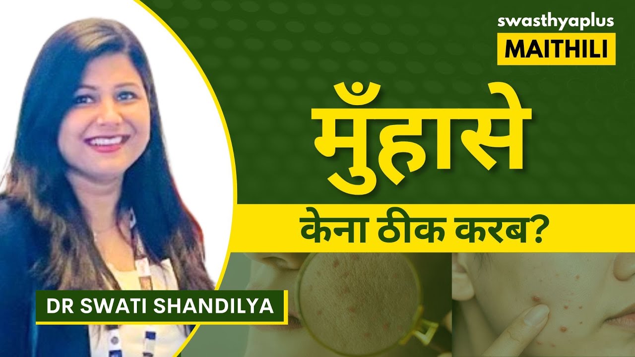 मुँहासे केना ठीक करब? | Acne: Causes & Treatment in Maithili | Pimples | Dr Swati Shandilya