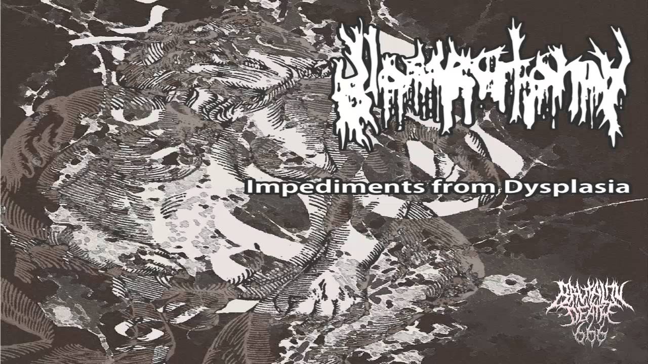 Glossectomy - Impediments From Dysplasia (2014) {Full-EP}