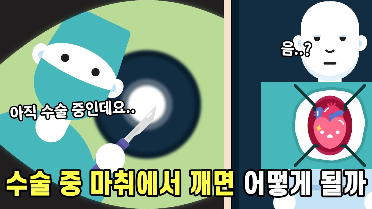 전신마취 수술 중 깨어나면 어떻게 될까