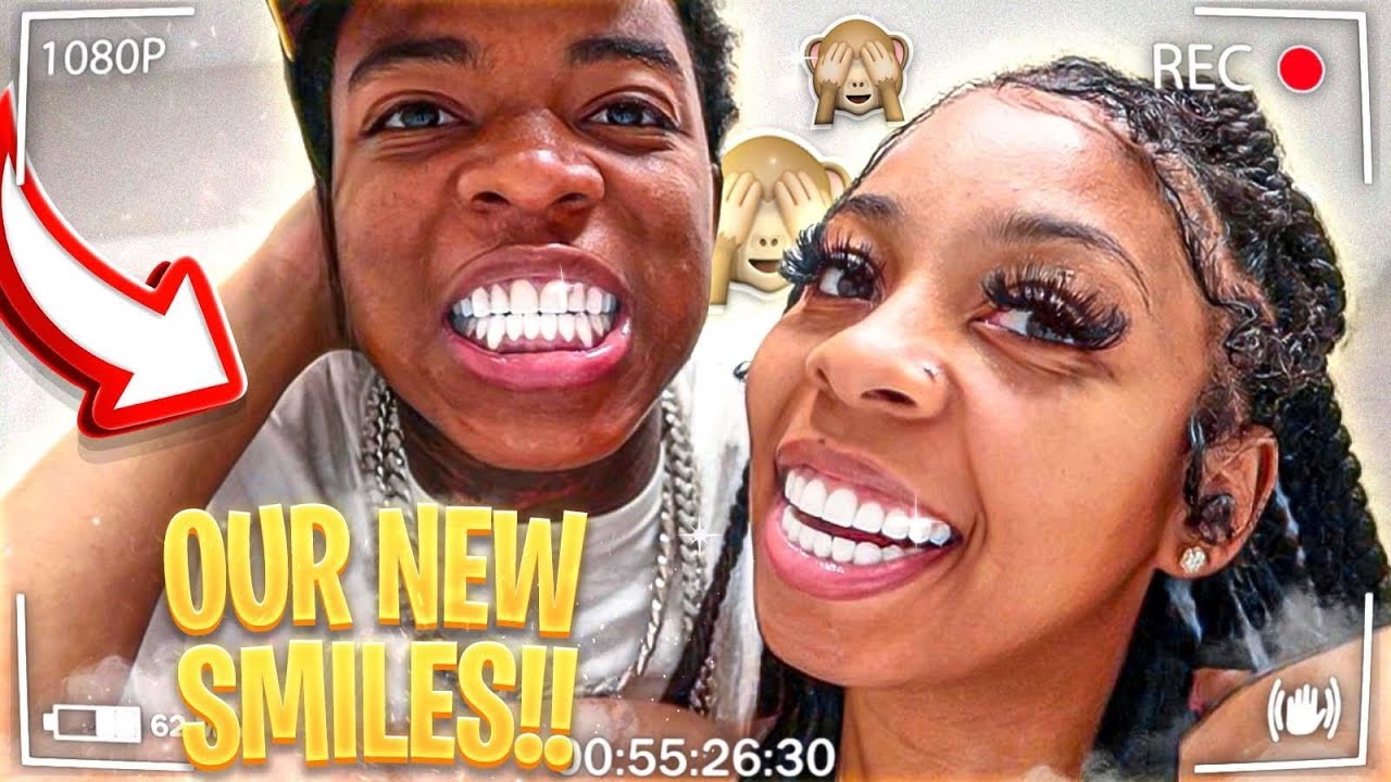WE GOT OUR TEETH DONE AT DENTAL DESIGN SMILE!