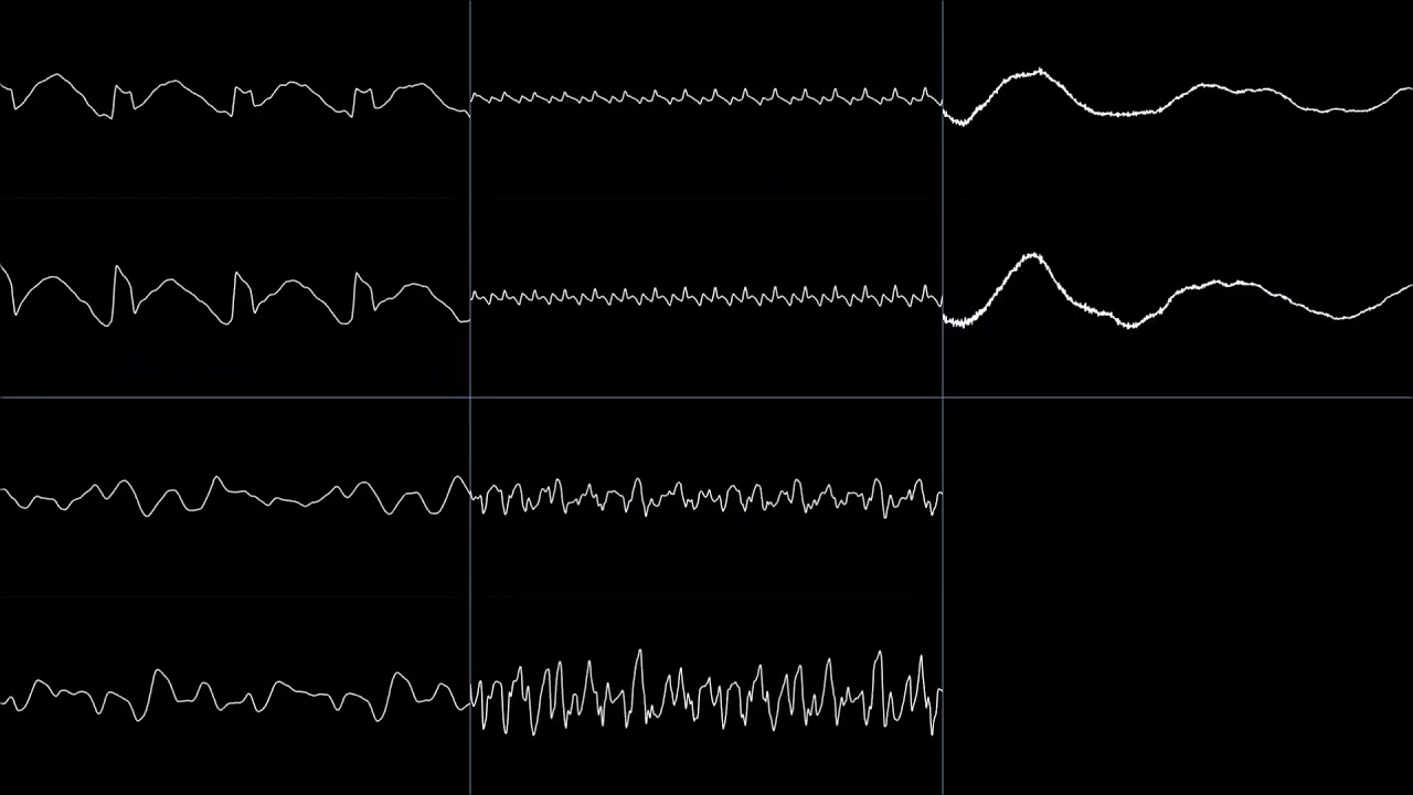 Space Quest III - Title [MT-32] but it keeps going for 1 hour