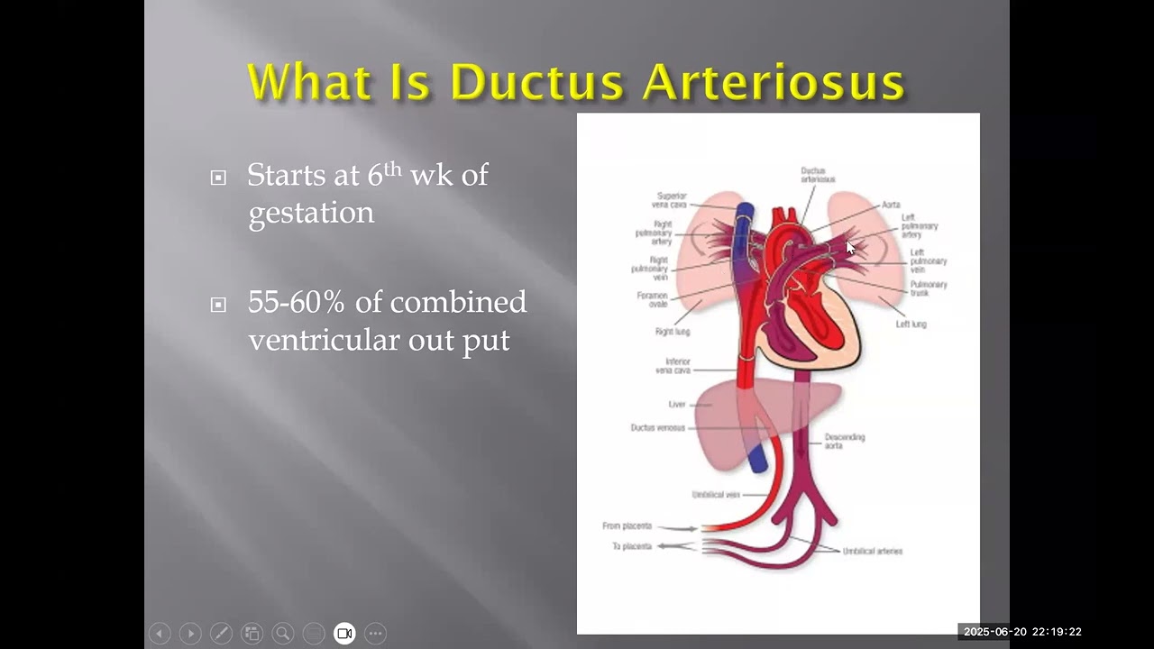 Approach to blue baby by Dr Saud Bahaidarah
