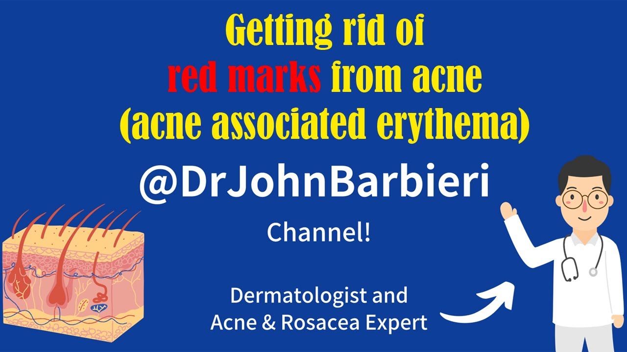 Fix acne red marks | Dermatologist explains in 3 mintues