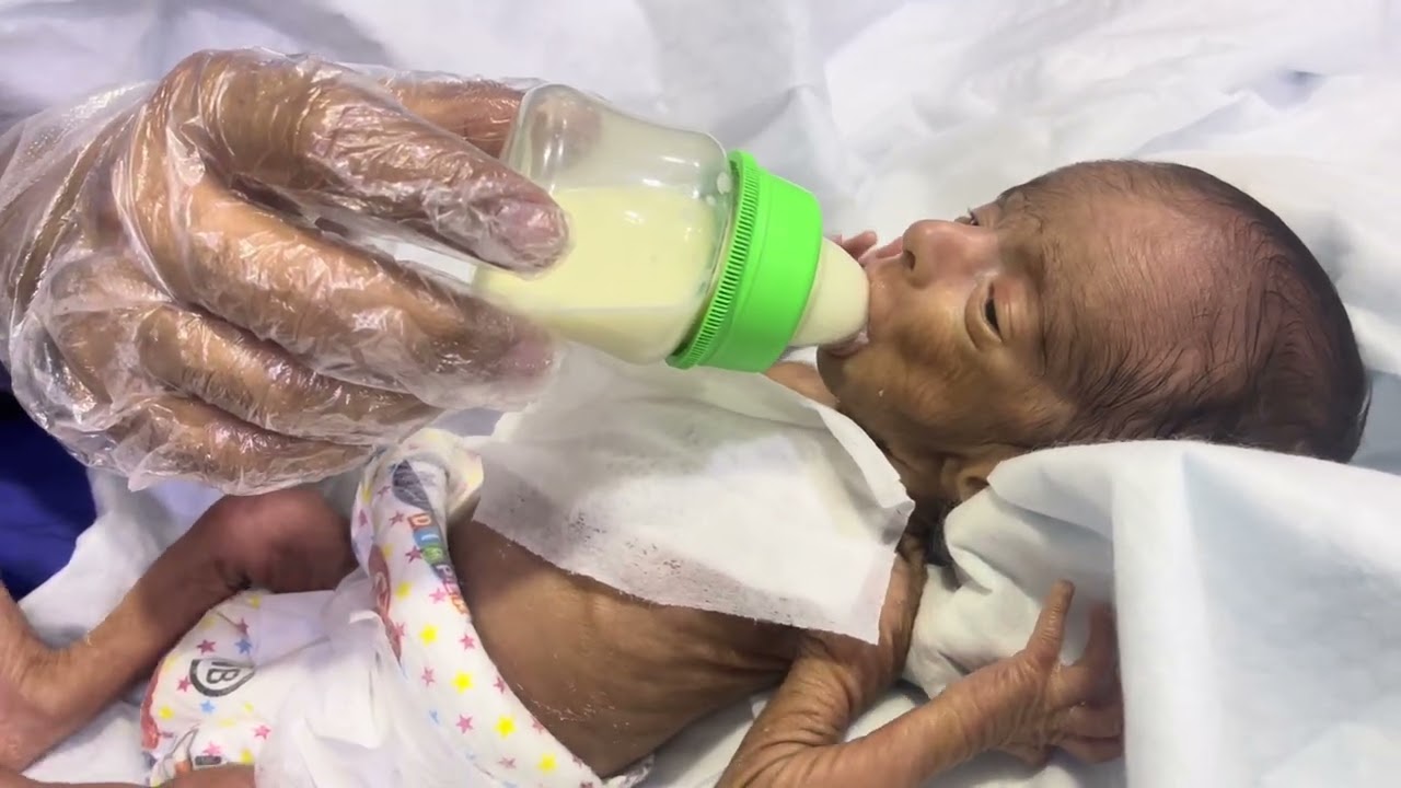 Feeding Premature So Tiny 👶🍼 | Adorable Little Preemie Feeding Moment #PrematureBaby #TinyBaby 