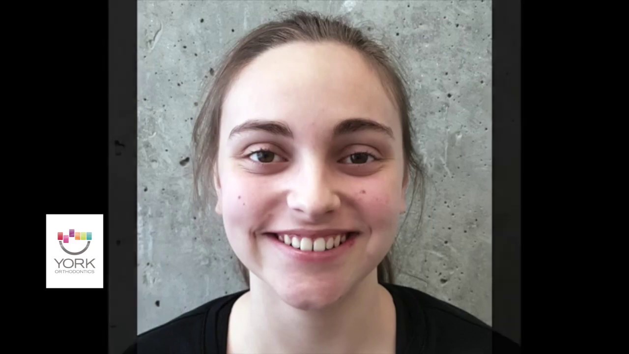 How To Take Your Own Orthodontic Photos