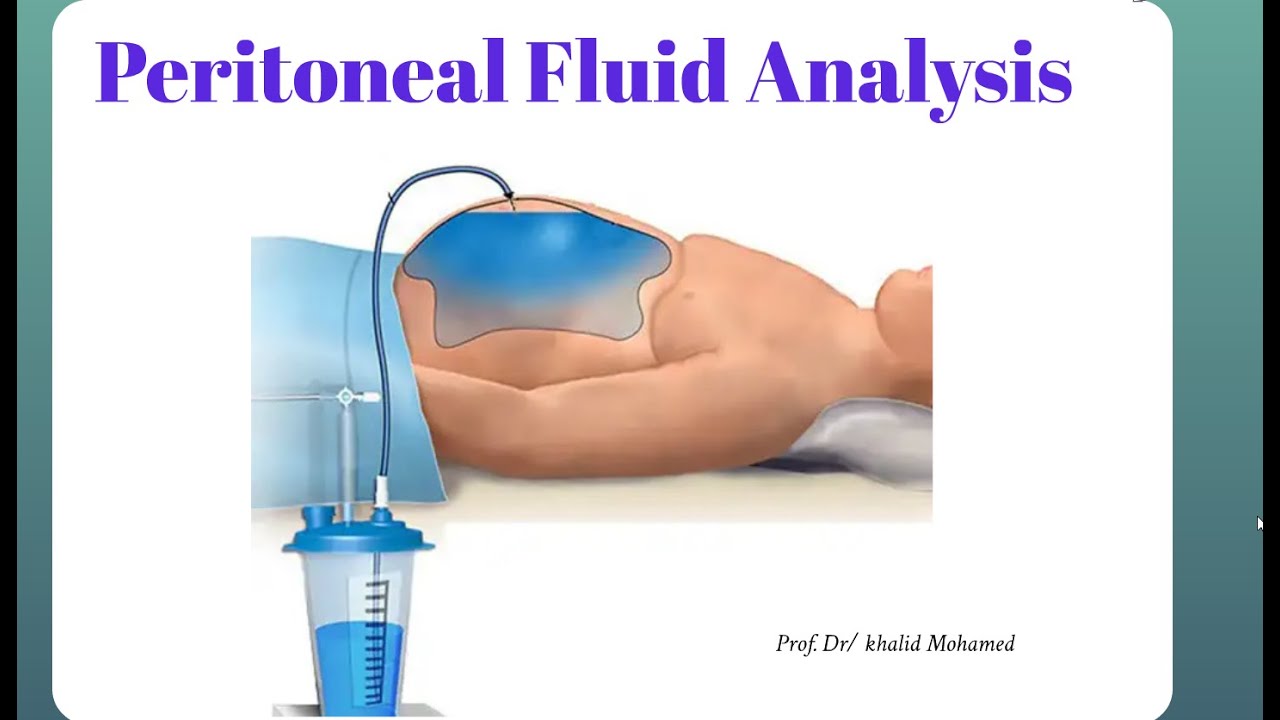 Peritoneal fluid. شرح بالعربي