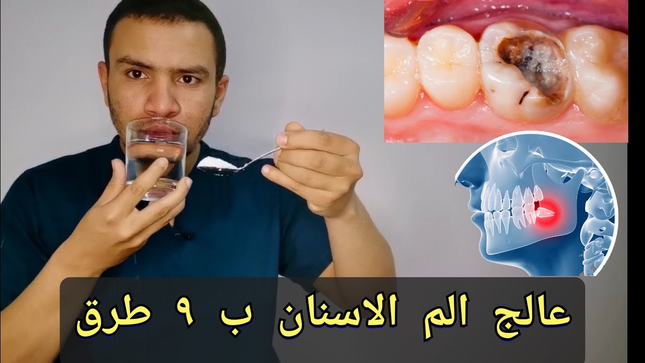 عالج الم ضرس العقل او اي ضرس ملتهب ب ٩ طرق سريعه و فعاله