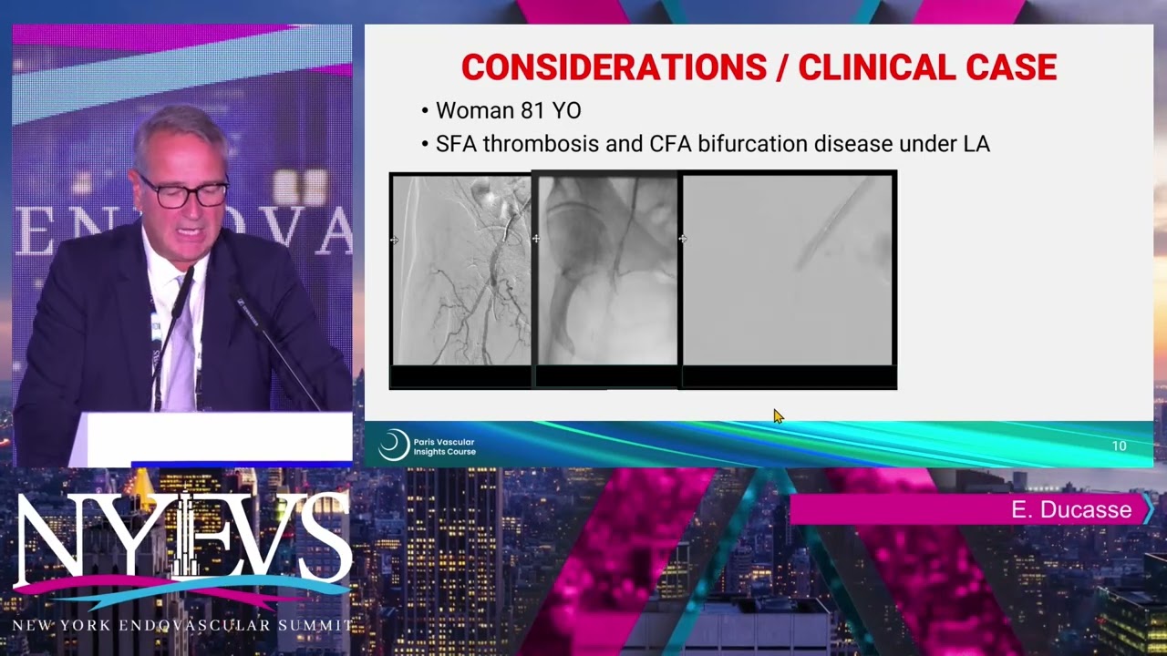 Endo vs Surgery for Common Femoral Disease The Great Debate - Surgery - Prof. Eric Ducasse