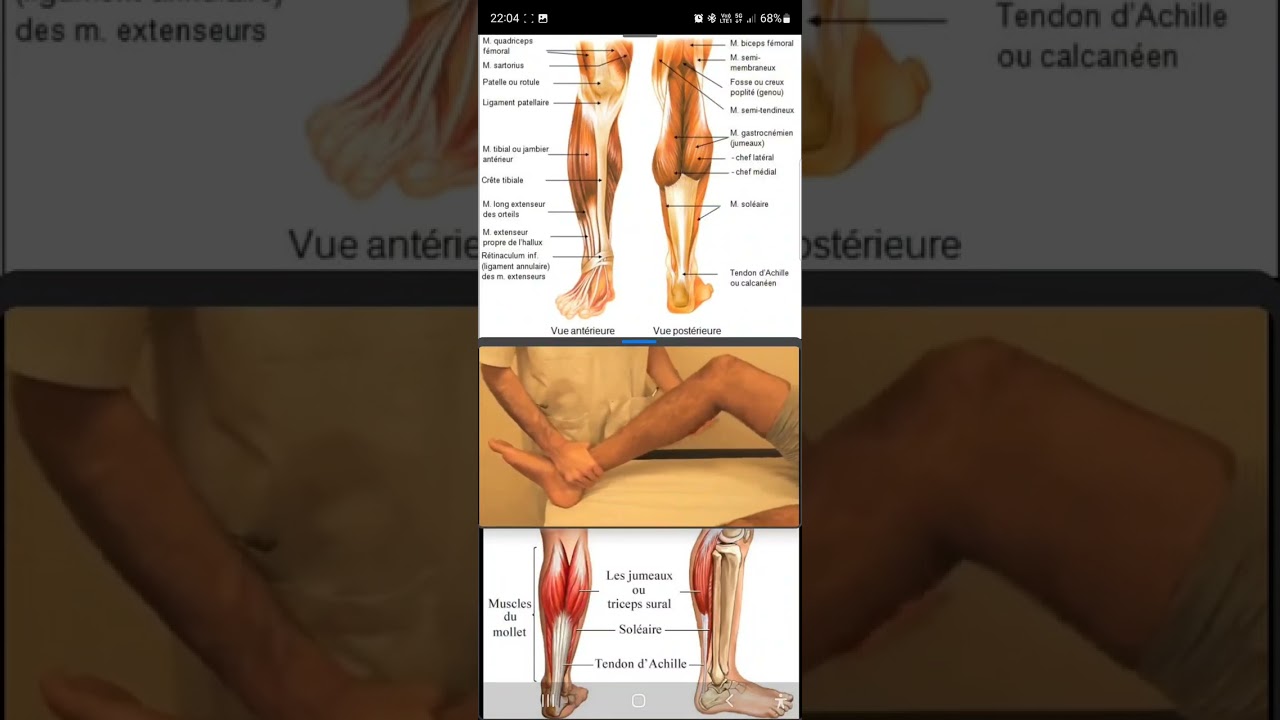 Palpation du mollet - 1