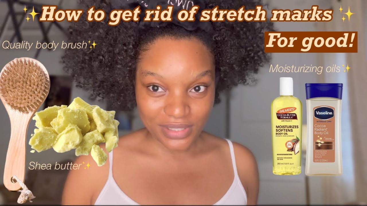 *very detailed* How to get rid of stretch marks for good✨✅ |no more stretch marks|#videorequest
