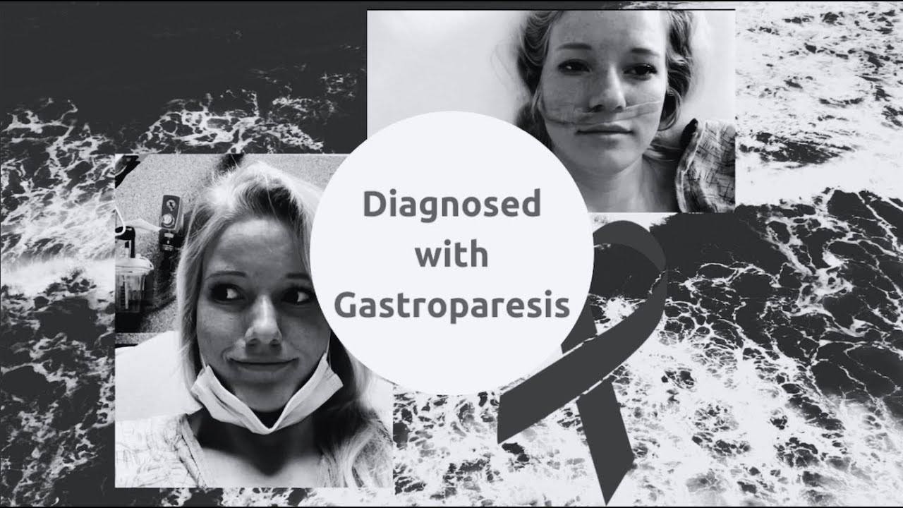 Diagnosed With Gastroparesis - GES, EGD, Manometry Studies