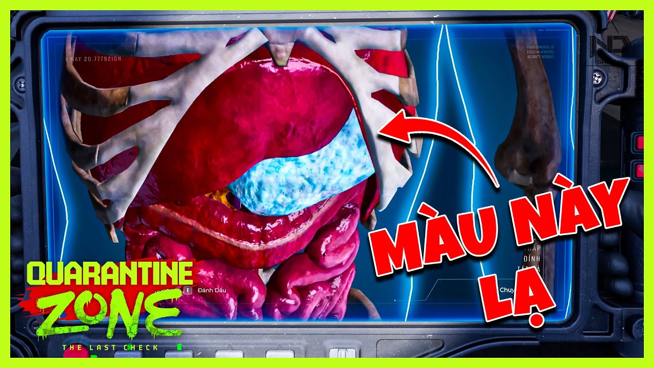PHÁT HIỆN BỆNH MỚI! Màu Sắc Kỳ Lạ Bên Trong Nội Tạng | Quarantine Zone #7