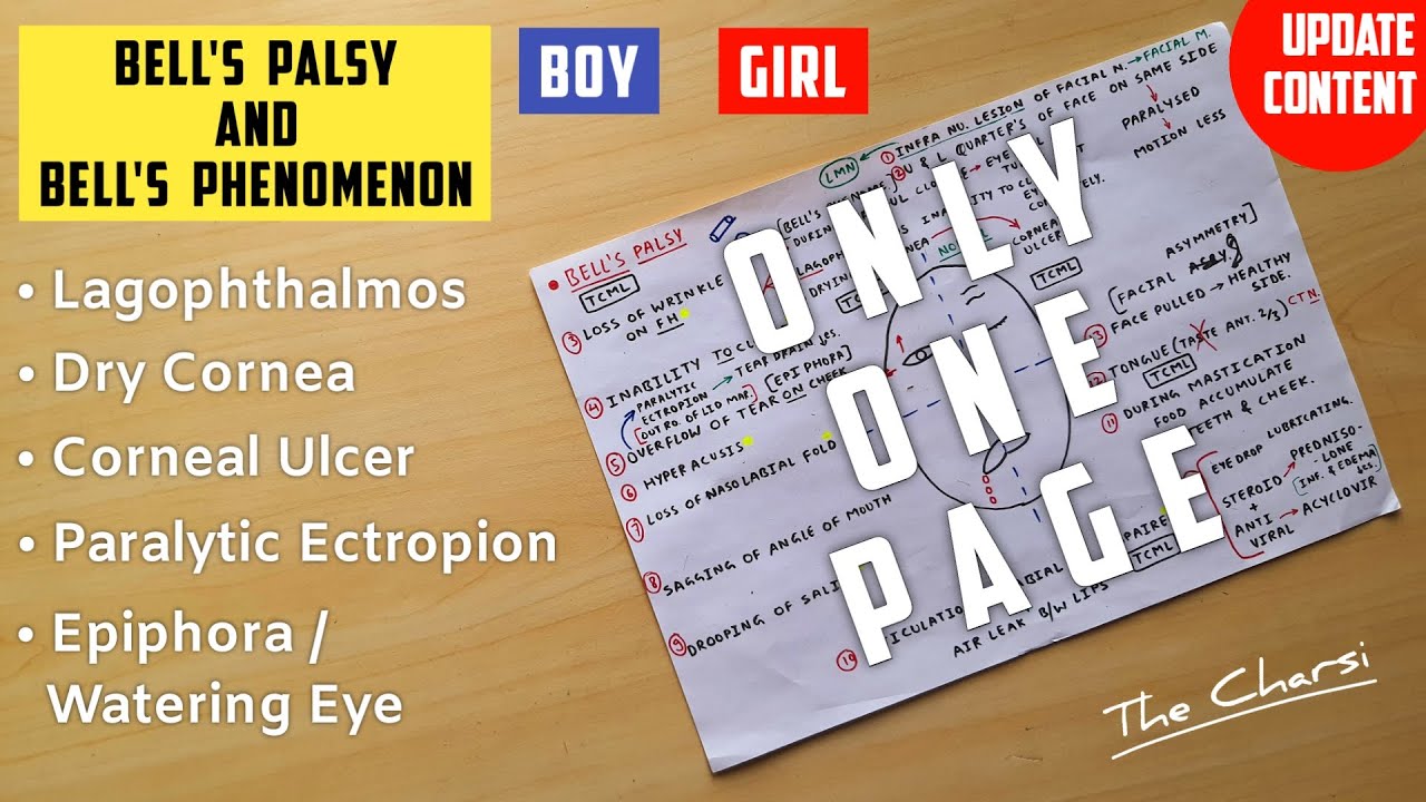 Bell's Palsy and Phenomenon 2/2 | Lagophthalomos, Dry Cornea, Corneal Ulcer and Watering Eye