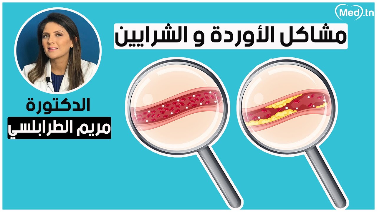 مشاكل الأوردة و الشرايين |  مع الدكتورة مريم الطرابلسي