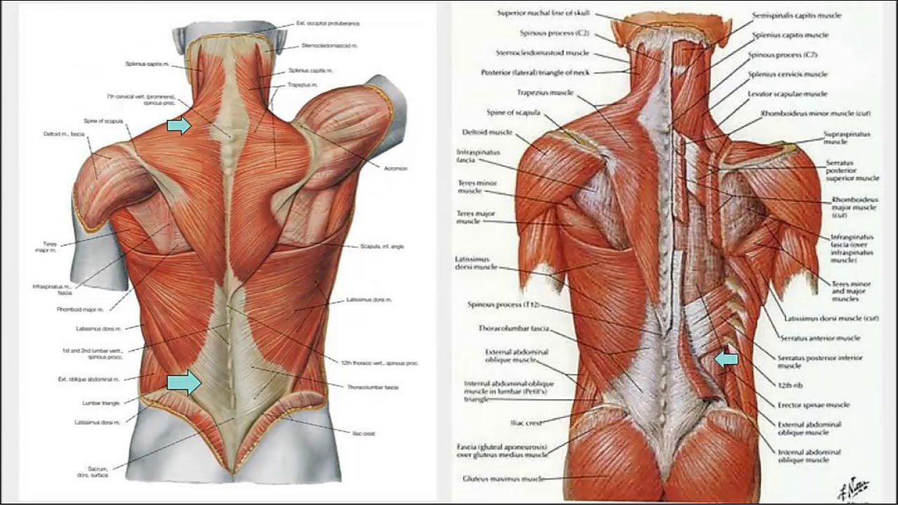 Back Pain