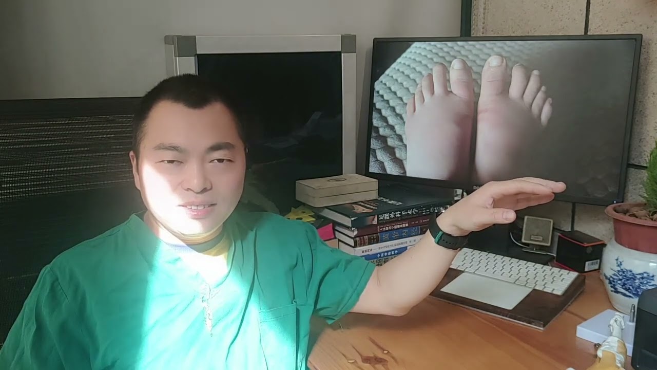 拇外翻矫正，拇外翻手术后恢复期的情况-hallux valgus