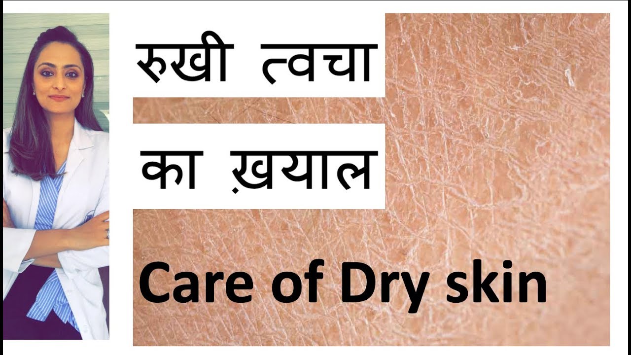 सुखी त्वचा /Dry skin  का ईलाज | dry skin का ख़याल  कैसे रखे | Hindi | home remedy | डॉ. आँचल पंत